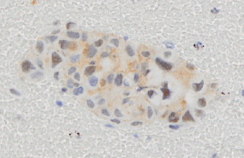 An oblong cluster of small, irregular purple shapes overlaid with brown