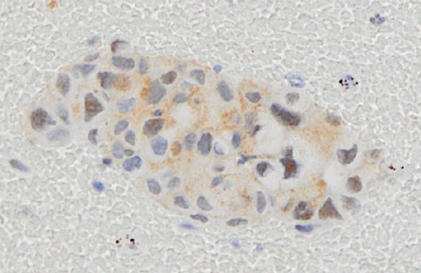 An oblong cluster of small, irregular purple shapes overlaid with brown 