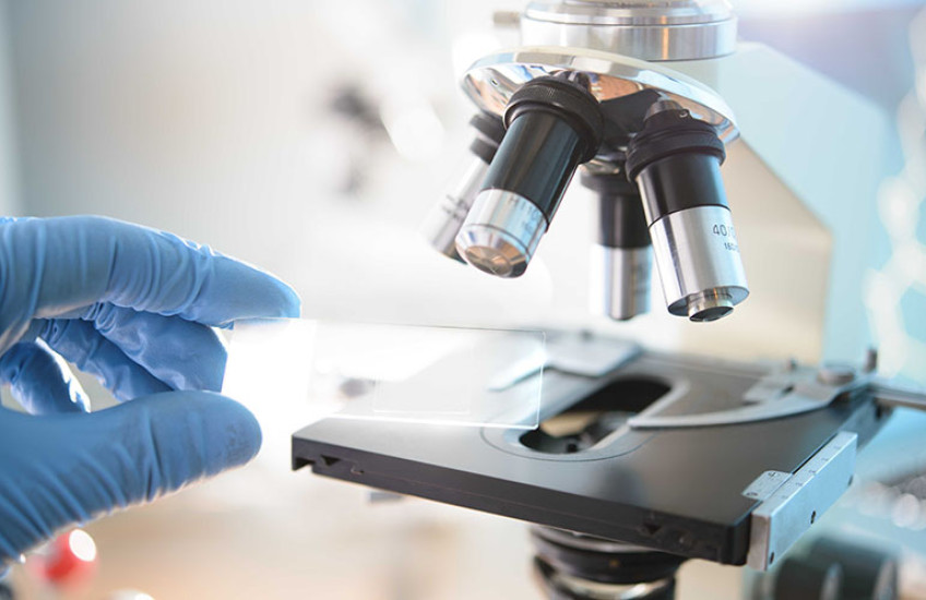 A gloved hand placing a glass microscope slide onto the stage of a compound microscope, with objective lenses in view, in a laboratory setting.