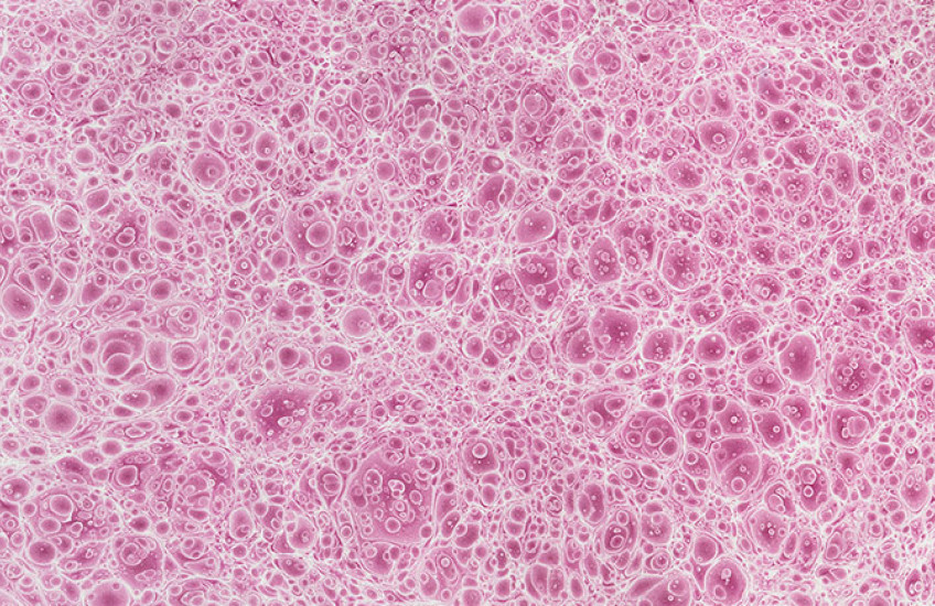 A sheet of textured paper with a pattern that appears to be dense, small, pink bubbles or cells.