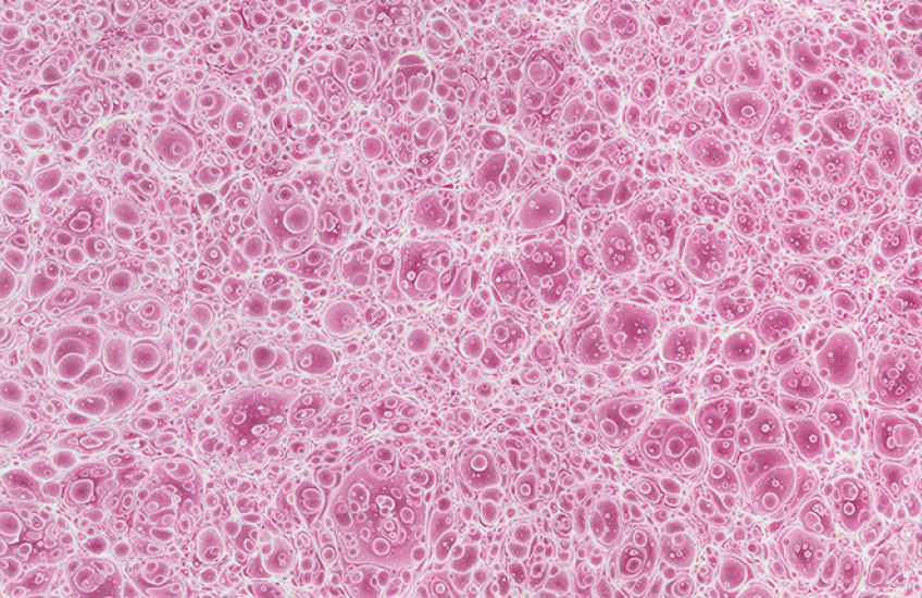 A sheet of textured paper with a pattern that appears to be dense, small, pink bubbles or cells.