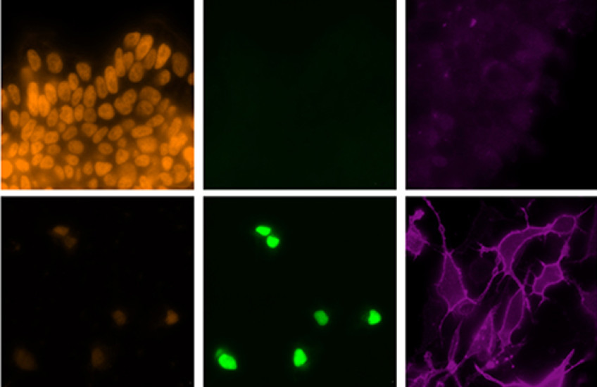 Top row: Untreated stem cells contain a protein (orange) marking its ability to mature into many different kinds of cells. Bottom row: Stem cells given a cocktail of transcription factors to coax them to become microglia-like cells express an array of proteins characteristic of human microglia. Images: Wyss Institute