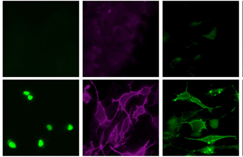 Top row: Untreated stem cells contain a protein (orange) marking its ability to mature into many different kinds of cells. Bottom row: Stem cells given a cocktail of transcription factors to coax them to become microglia-like cells express an array of proteins characteristic of human microglia. Image: Wyss Institute