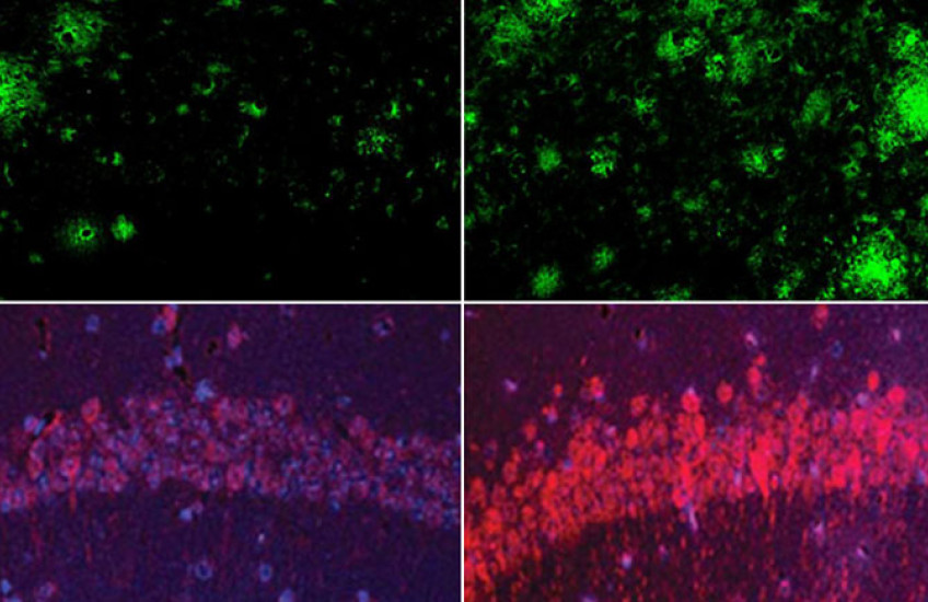 One pair of boxes shows fewer green amyloid clusters on the left and more on the right. Another pair of boxes shows a dim arc of purple and red tau on the left and a brighter arc on the right.