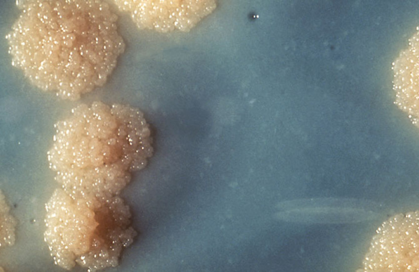 Close-up image of Mycobacterium tuberculosis bacterial colonies growing on a solid nutrient medium. The colonies appear rough, irregular, buff-colored, and bubbly, resembling small cauliflower-like clusters on a blue-gray background.
