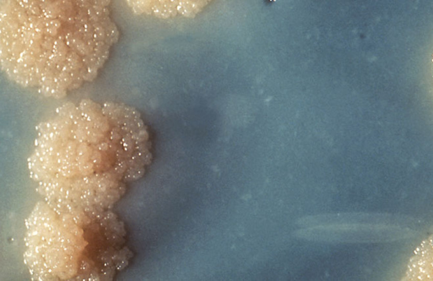 Close-up image of Mycobacterium tuberculosis bacterial colonies growing on a solid nutrient medium. The colonies appear rough, irregular, buff-colored, and bubbly, resembling small cauliflower-like clusters on a blue-gray background.