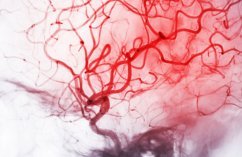 A network of thin red lines on skull-shaped gray background