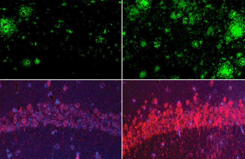 One pair of boxes shows fewer green amyloid clusters on the left and more on the right. Another pair of boxes shows a dim arc of purple and red tau on the left and a brighter arc on the right.