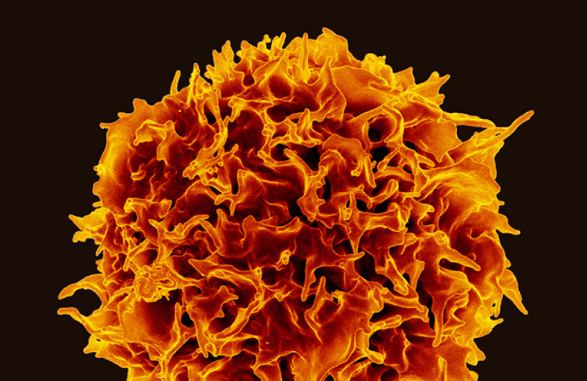 A spherical cell with an irregular surface, colored orange and red against a black background.