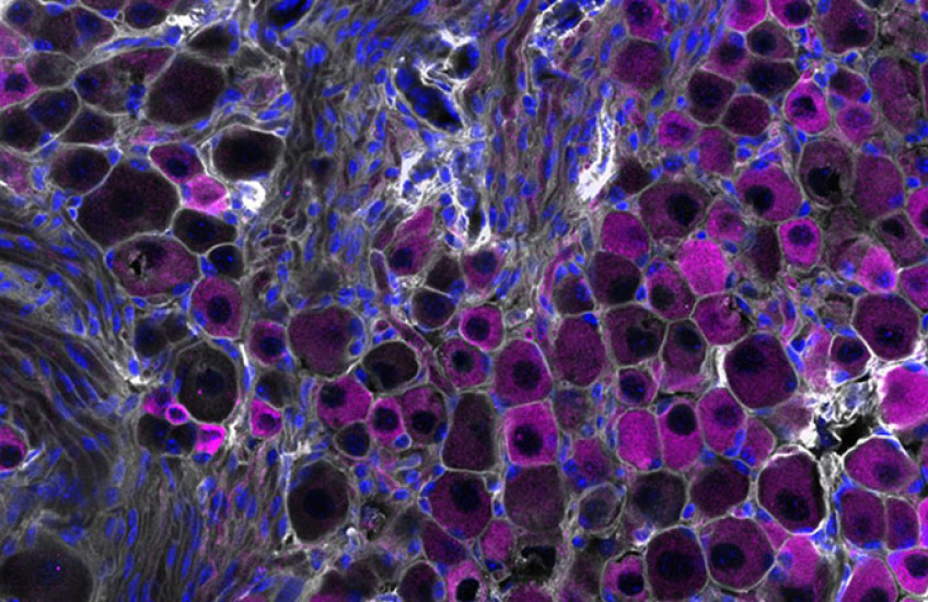 Microscopy image of vagus nerve sensory cells