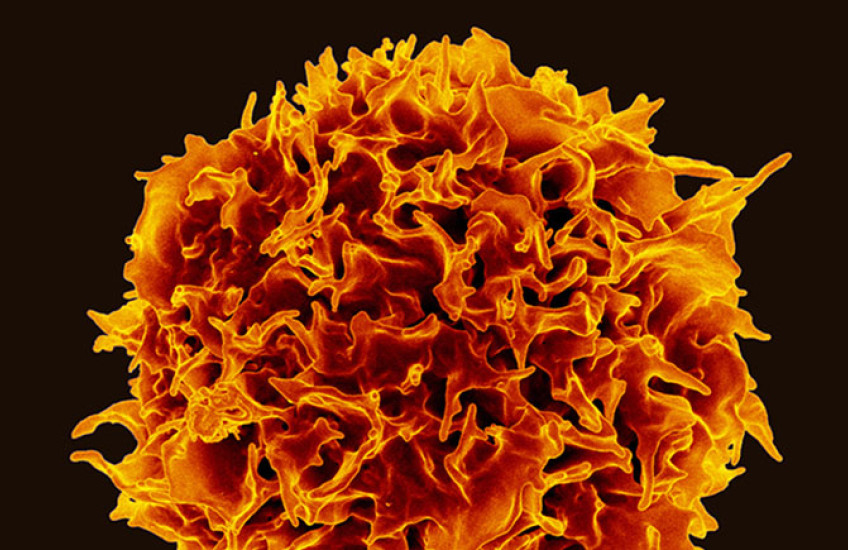 A spherical cell with an irregular surface, colored orange and red against a black background.