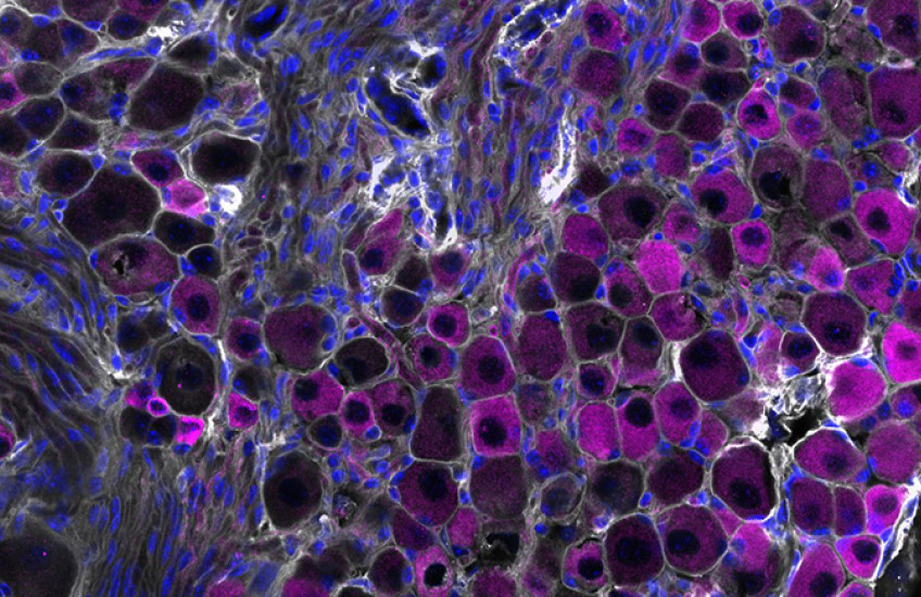 Microscopy image of vagus nerve sensory cells