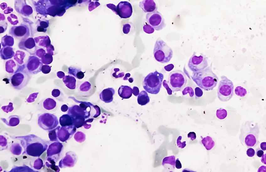 Clusters of purple circles on a white background