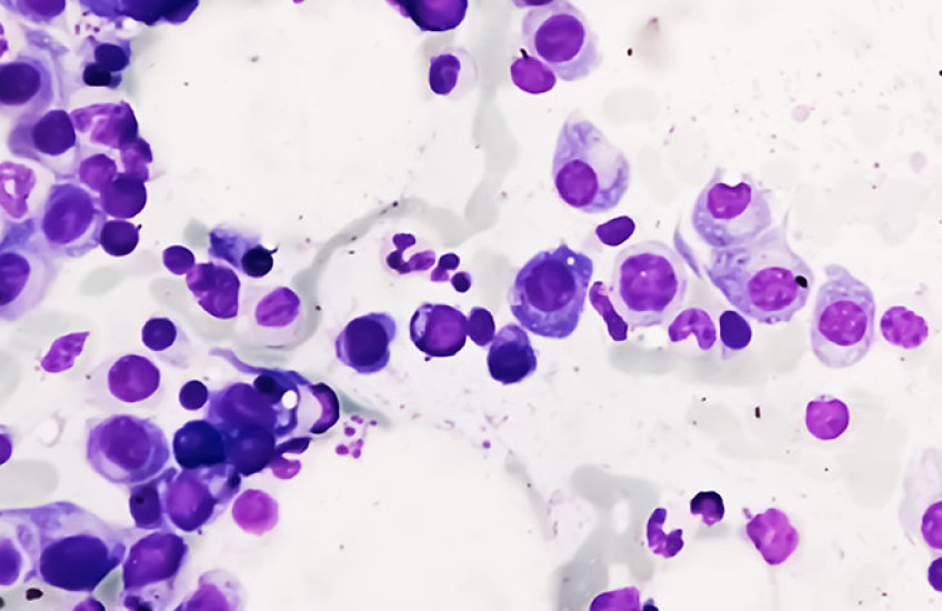 Clusters of purple circles on a white background