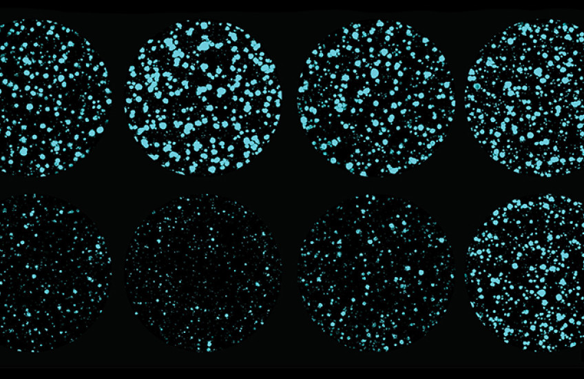 Eight circular views under a microscope of clusters of cells, ranging from sparse to dense