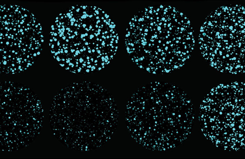 Eight circular views under a microscope of clusters of cells, ranging from sparse to dense