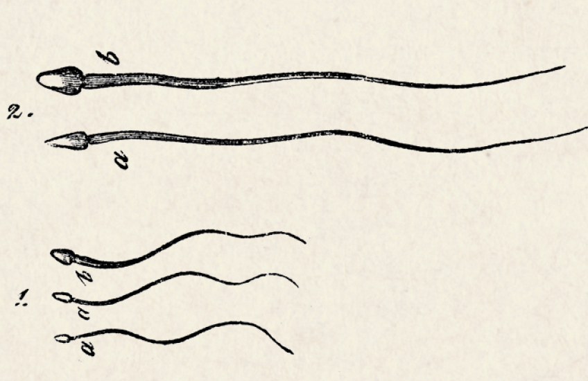 Black drawings of sperm, two big and three small, on a tan background. 