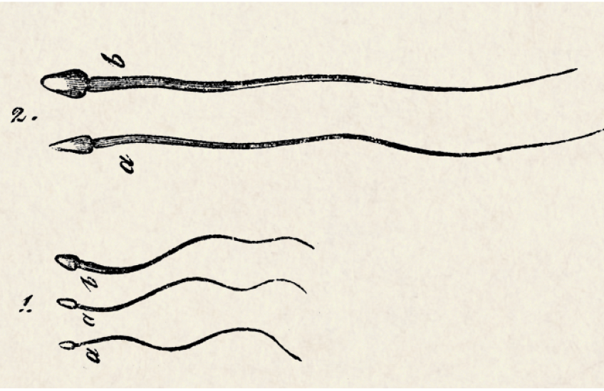 Black drawings of sperm, two big and three small, on a tan background. 