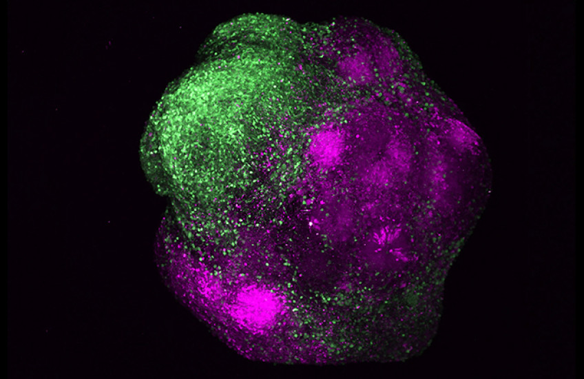 A ball-like structure under a microscope. One side is mostly green and the other mostly magenta.