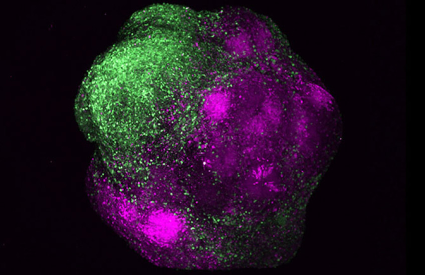 A ball-like structure under a microscope. One side is mostly green and the other mostly magenta.