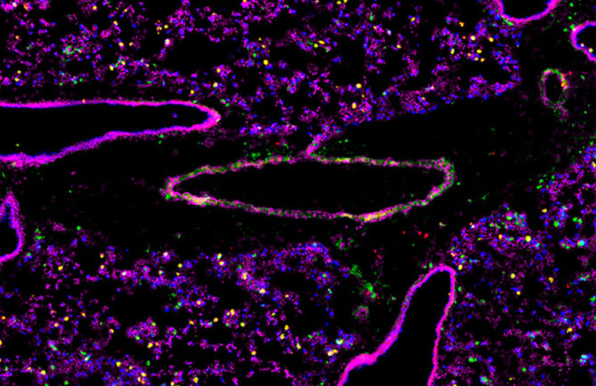 Cross-section of lung tissue shows 6 structures with bright pink outlines and hollow middles, amid purple, green, yellow, and blue dots like a starfield.