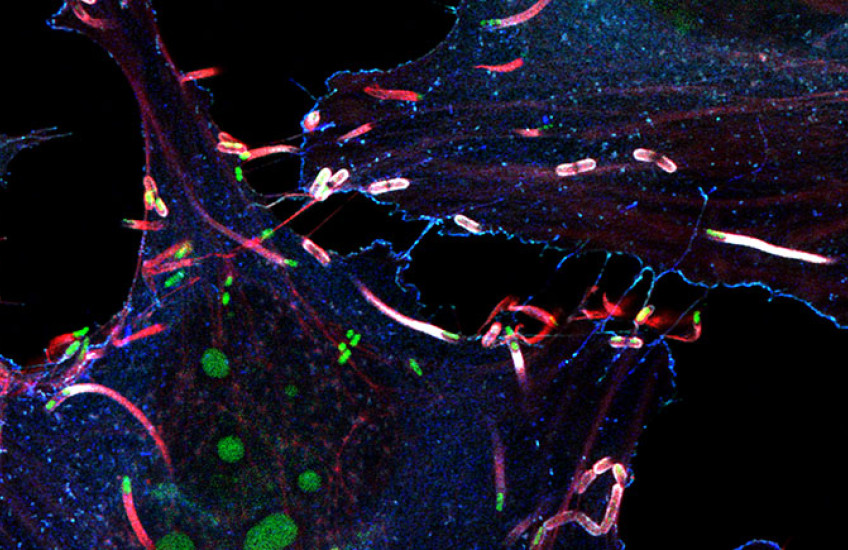 Fluorescence microscopy image of cultured cells showing green listeria trailing red comet tails of actin filaments. The background is black, making the brightly colored bacteria and cellular structures stand out vividly.