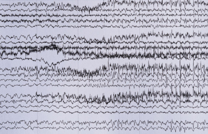A series of irregularly spiky, black horizontal lines on a white background