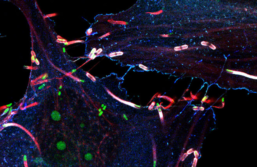 Fluorescence microscopy image of cultured cells showing green listeria trailing red comet tails of actin filaments. The background is black, making the brightly colored bacteria and cellular structures stand out vividly.