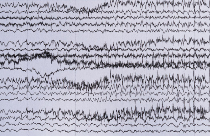 A series of irregularly spiky, black horizontal lines on a white background