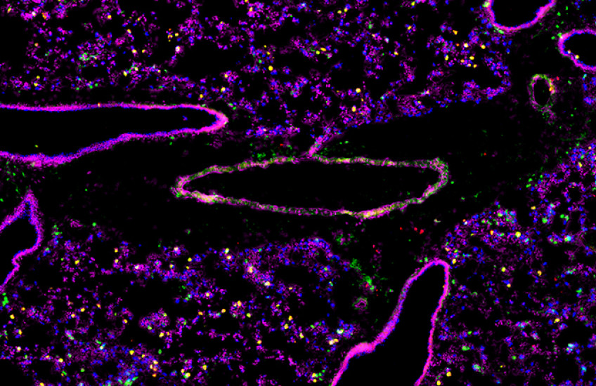 Cross-section of lung tissue shows 6 structures with bright pink outlines and hollow middles, amid purple, green, yellow, and blue dots like a starfield.