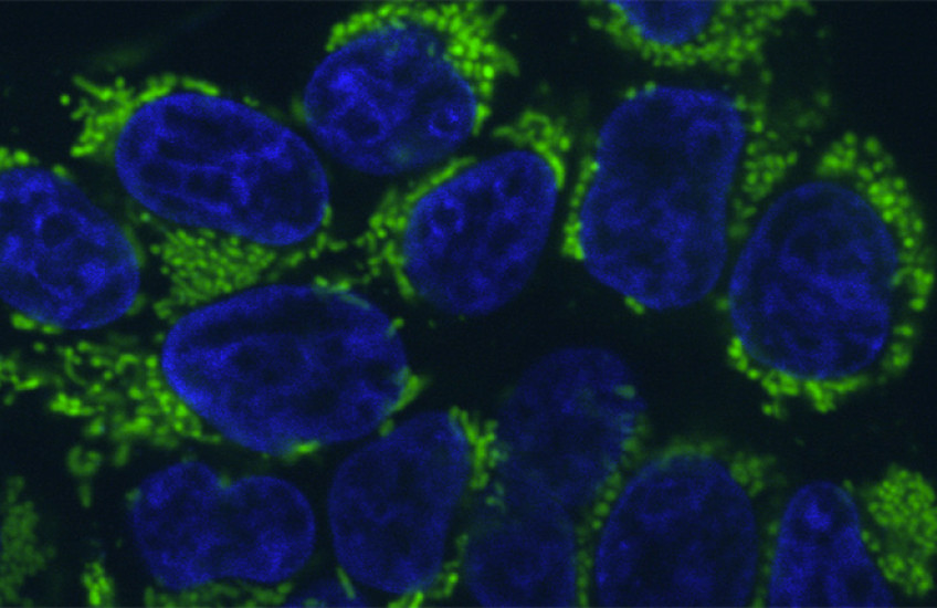 A microscope imaging showing a cluster of round blue shapes surrounded by bright green and black