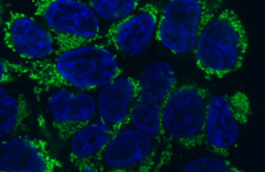 A microscope imaging showing a cluster of round blue shapes surrounded by bright green and black