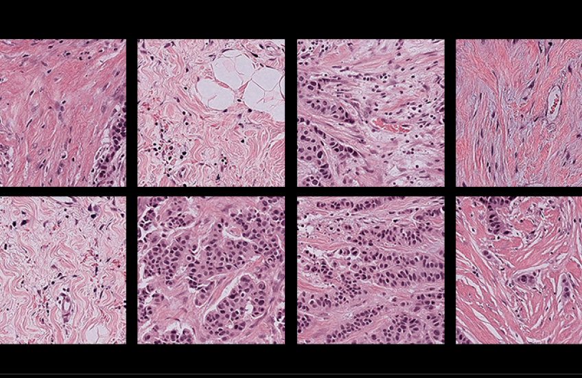 Two rows of four pink and purple microscope images with a black border