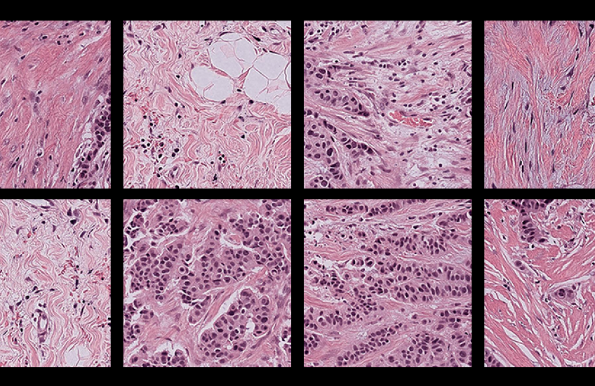 Two rows of four square pink and purple microscope images with a black border