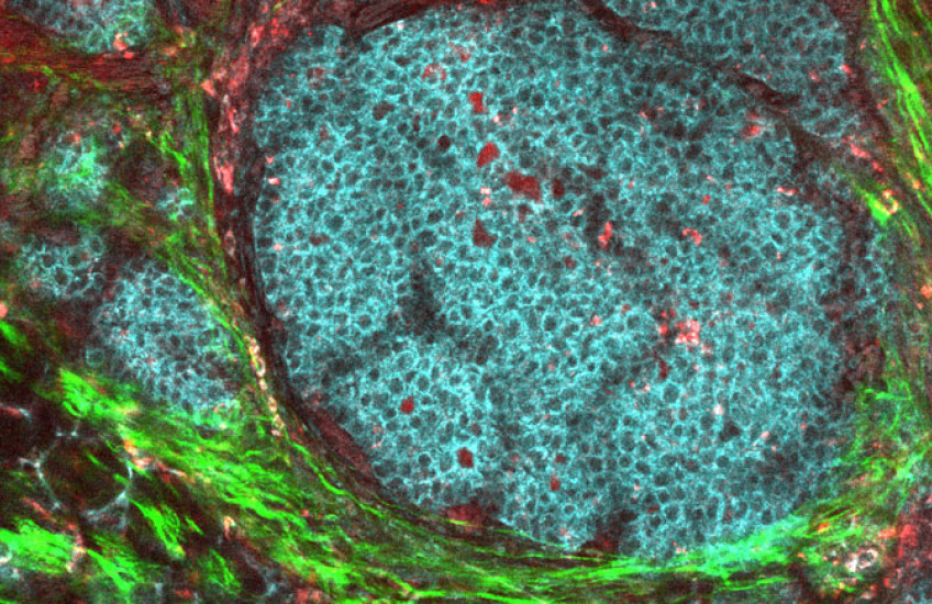 A round cluster of blue cells surrounded by bright green and dark red tissue