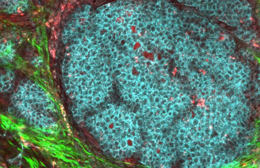 A round cluster of blue cells surrounded by bright green and dark red tissue