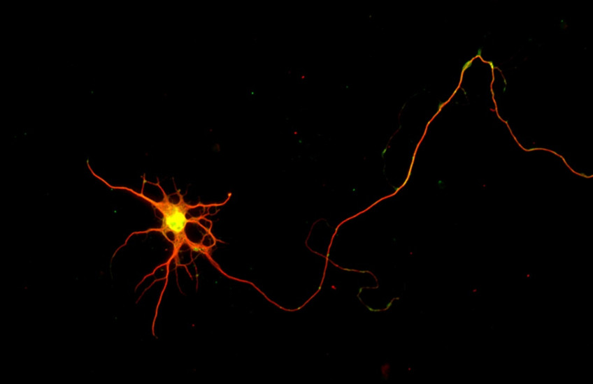 A long, spindly neuron glows lava orange-red against a black background through a microscope