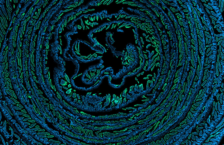 A swirling spiral of glowing blue and green dots showing cells in a tissue sample, with green dots showing cells that have reacted to cytokines.