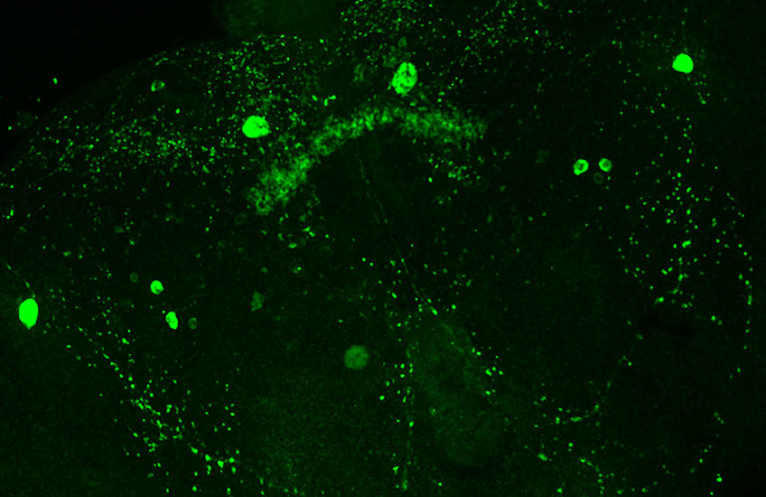 Microscopy shows a constellation of green dots, forming the outline of a fruit fly brain structure.