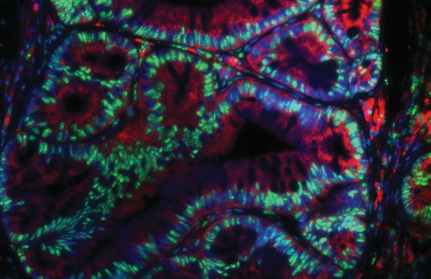 Swirls of cells lit up in green, blue, and red