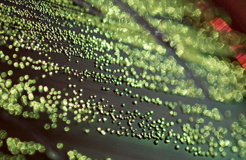 Macro photograph of a petri dish covered in green droplets with a metallic sheen, sharp at center frame and blurred in foreground and background.