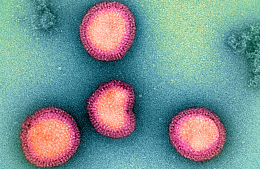 Four influenza particles appear as studded spheres, one indented like a kidney bean. The image has been artificially colored so the particles stand out against the background of a petri dish.