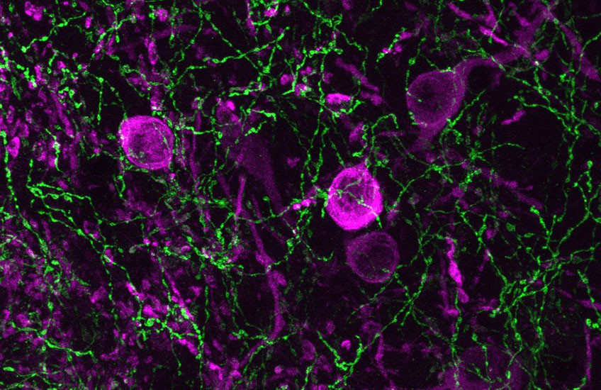 Microscopic view of brain cells shows a matrix of spindly green axons and round magenta cell bodies.