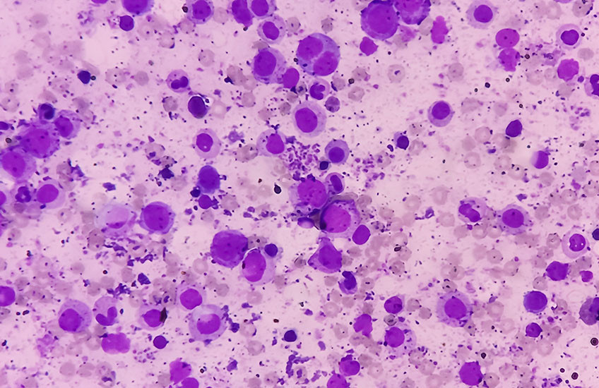 Microscopic image showing numerous purple-stained cells of varying sizes scattered across a pale pink background.