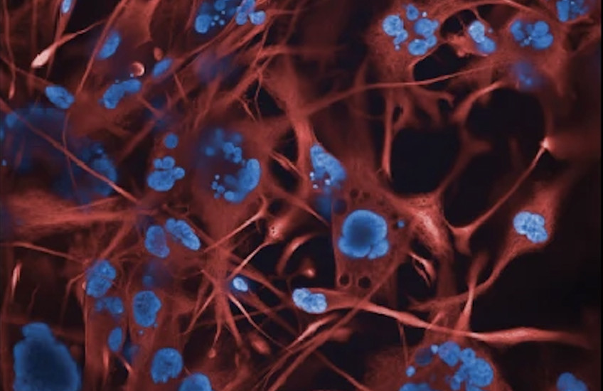 Cell culture shows a matrix of red and blue.