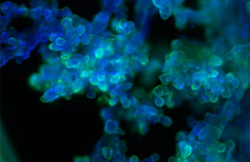 Seen through a microscope, placental villi are fluorescently stained green, cyan, and blue.