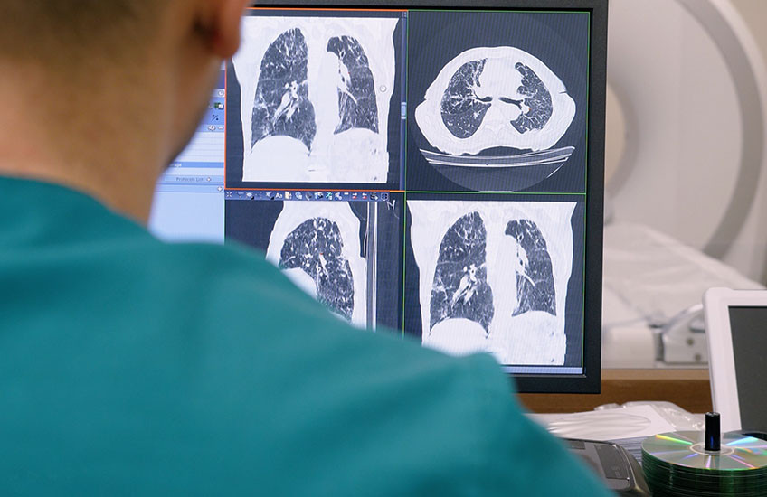 A radiologist in a green shirt looks at a screen showing four images of CT lung scans; a white CT scanner appears blurred in the background. 