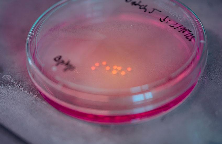 A photo of a petri dish with nine brain organoids, which look like small, white balls, resting on the bottom.