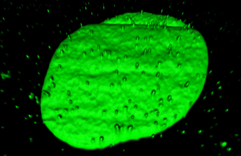Glowing green blobs of DNA emerging from the nucleus of a human cell in a lab dish.