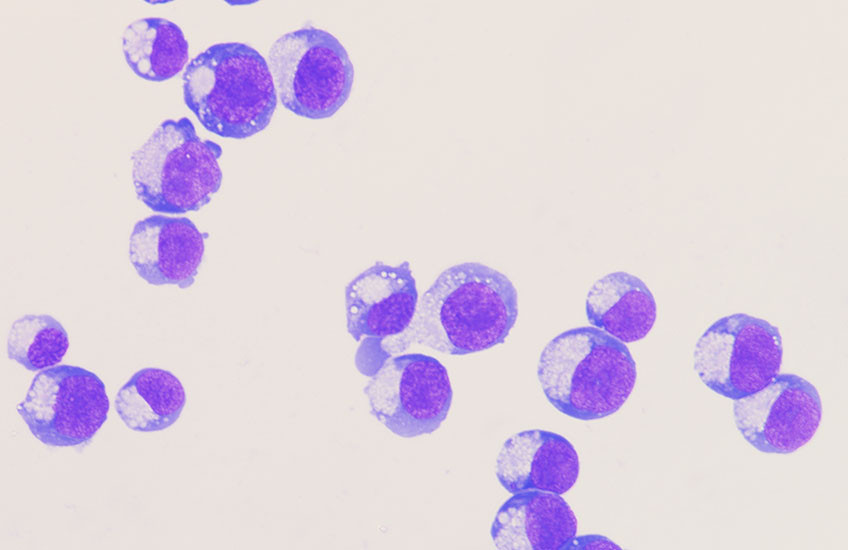 About two dozen cells are seen under a microscope. Part of each cell is stained purple like a half-moon.